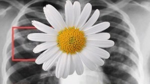 Информационный час «Белая ромашка»